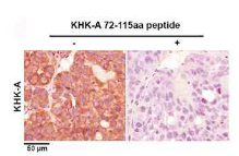 KHK Isoform A Antibody[21708]