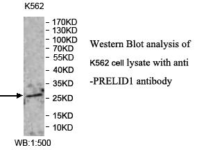PRELID1 Antibody[39979]