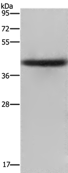EPSTI1 Antibody[36445]