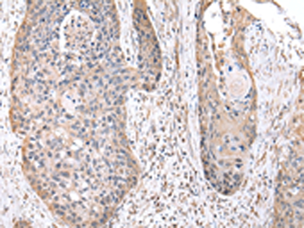 RPS10 Antibody[43045]