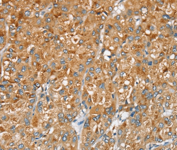 SERINC2 Antibody[37912]