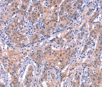 EP300 Antibody[37550]