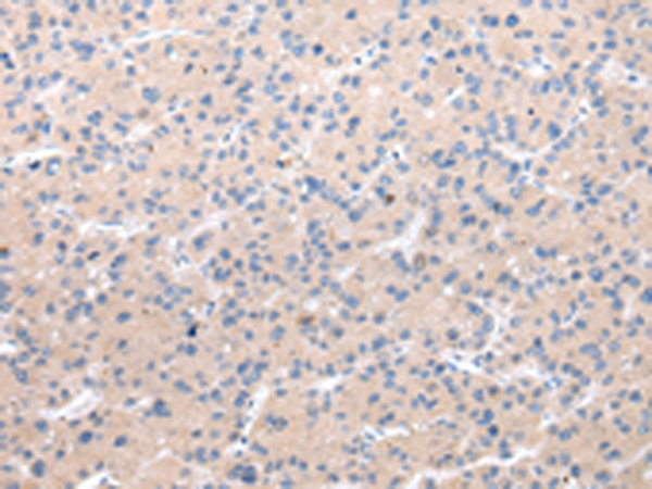 CHRM5 Antibody[43235]