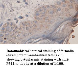 P311 Antibody[39353]