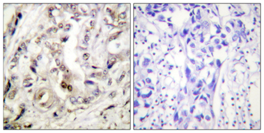 PR Polyclonal Antibody[44262]