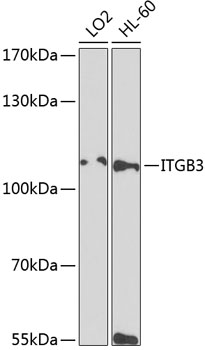 ITGB3 antibody[38420]