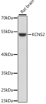 KCNS2 Rabbit Polyclonal Antibo