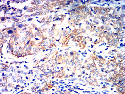 siglec15 Mouse mAb[64233]