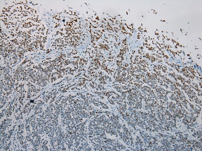 S1PR2 Antibody[40195]