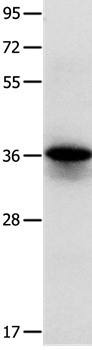 MYOZ1 Antibody[35825]
