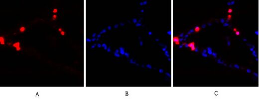 PKC Polyclonal Antibody[41347]