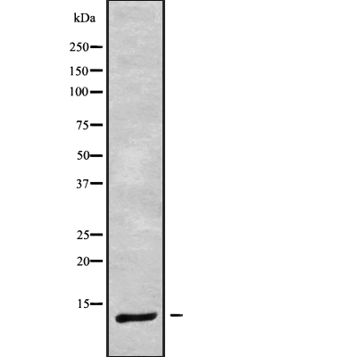 DYNLRB1 Antibody[45947]