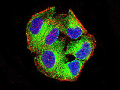 RHOA Mouse mAb[64181]