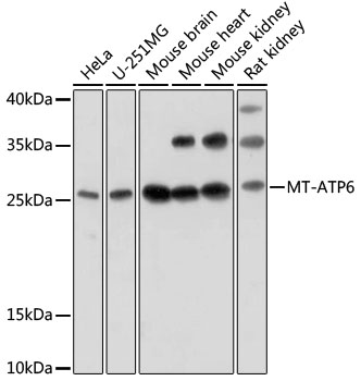 MT-ATP6 Rabbit Polyclonal Anti