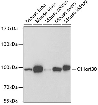 C11orf30 antibody[38728]
