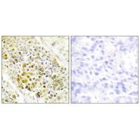 DLX5 Antibody[33825]
