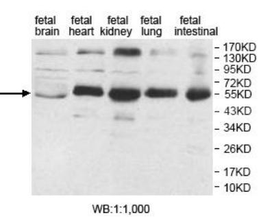 AP1M2 Antibody[39922]