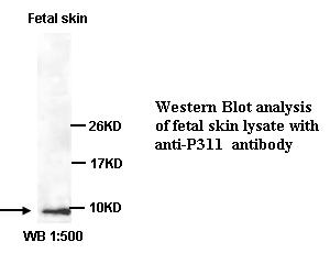 P311 Antibody[39353]