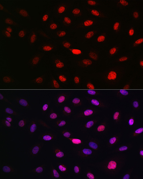 WBP11 Rabbit Polyclonal Antibo