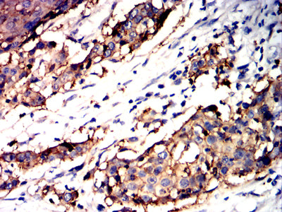 TACSTD2 Mouse mAb[64296]