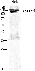 SREBP-1 Polyclonal Antibody[41