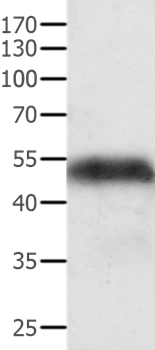 ACPP Antibody[35560]