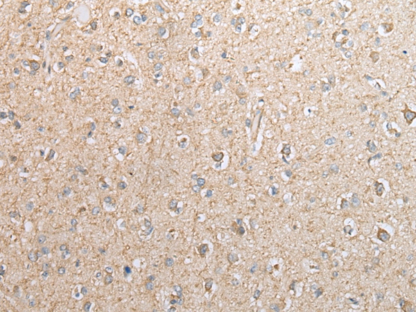 EBI3 Antibody[42991]