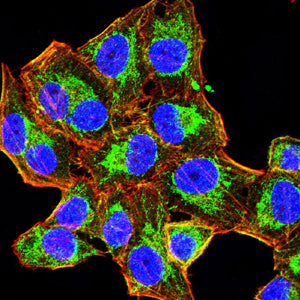 HAS1 Mouse mAb[63714]