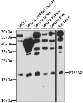 PTP4A2 Polyclonal Antibody[292