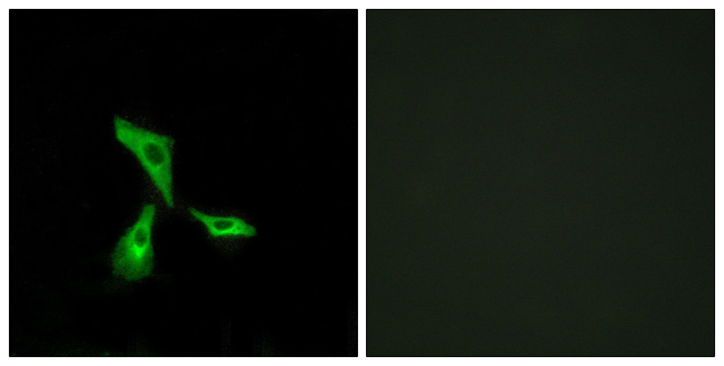GPR101 Polyclonal Antibody[409