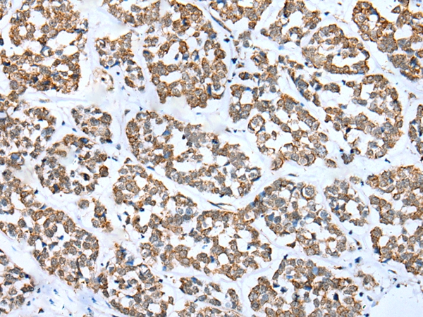 FSD1L Antibody[43362]