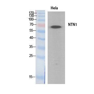 Netrin-1 Polyclonal Antibody[4