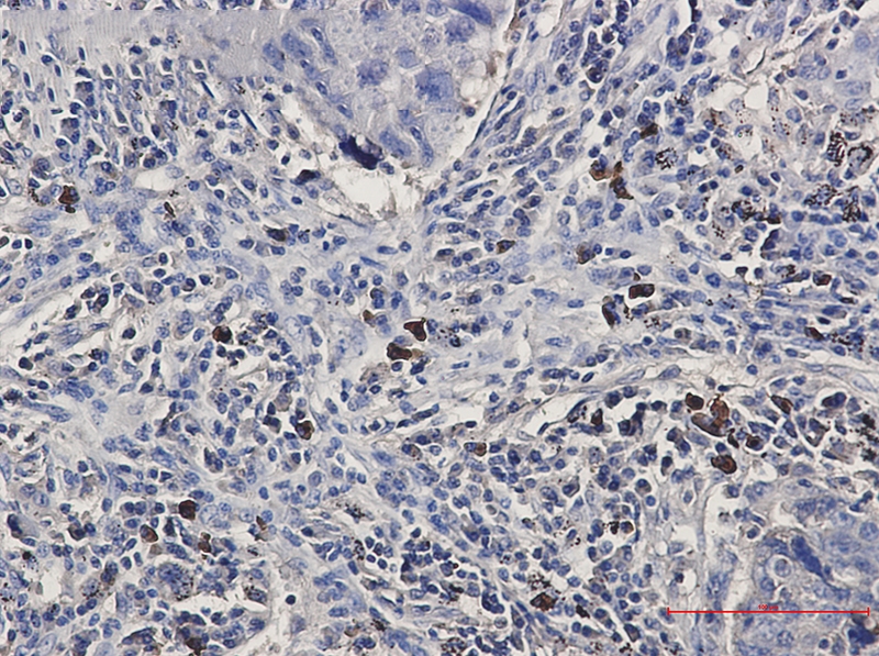 BNIP3L Rabbit mAb[52179]