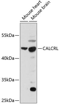 CALCRL Rabbit Polyclonal Antib