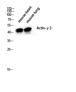 Actin α3 Polyclonal Antibody[4