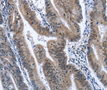 CADM3 Antibody[36298]