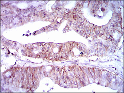 LPA Antibody[48474]