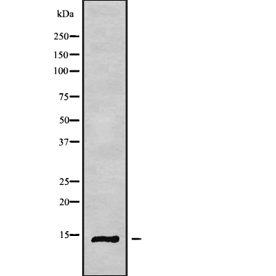 RPS26L1 Antibody[45726]