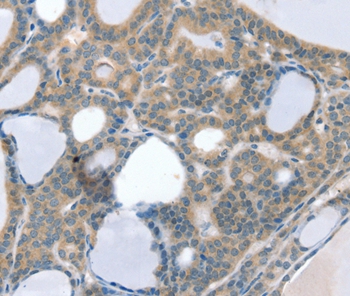 SOD4 Antibody[37969]