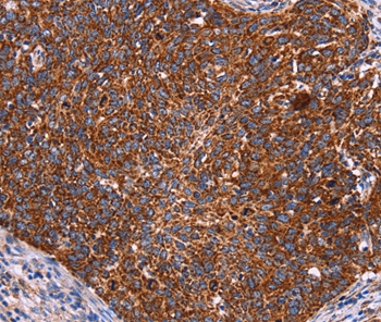 CROT Antibody[36373]
