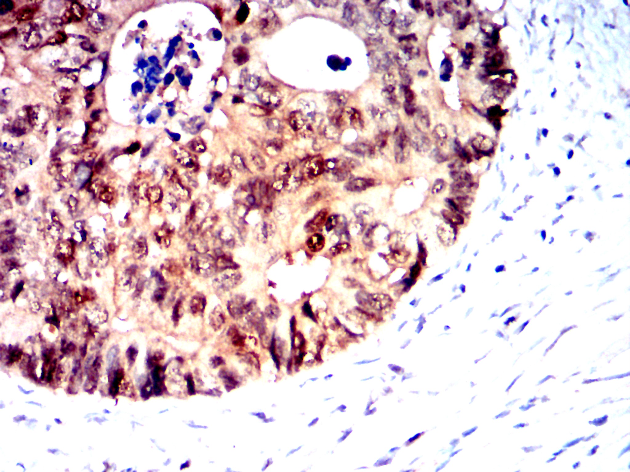 AKR1C1 Mouse mAb[63040]