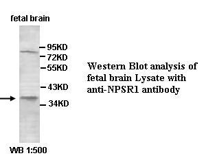 NPSR1 Antibody[39424]