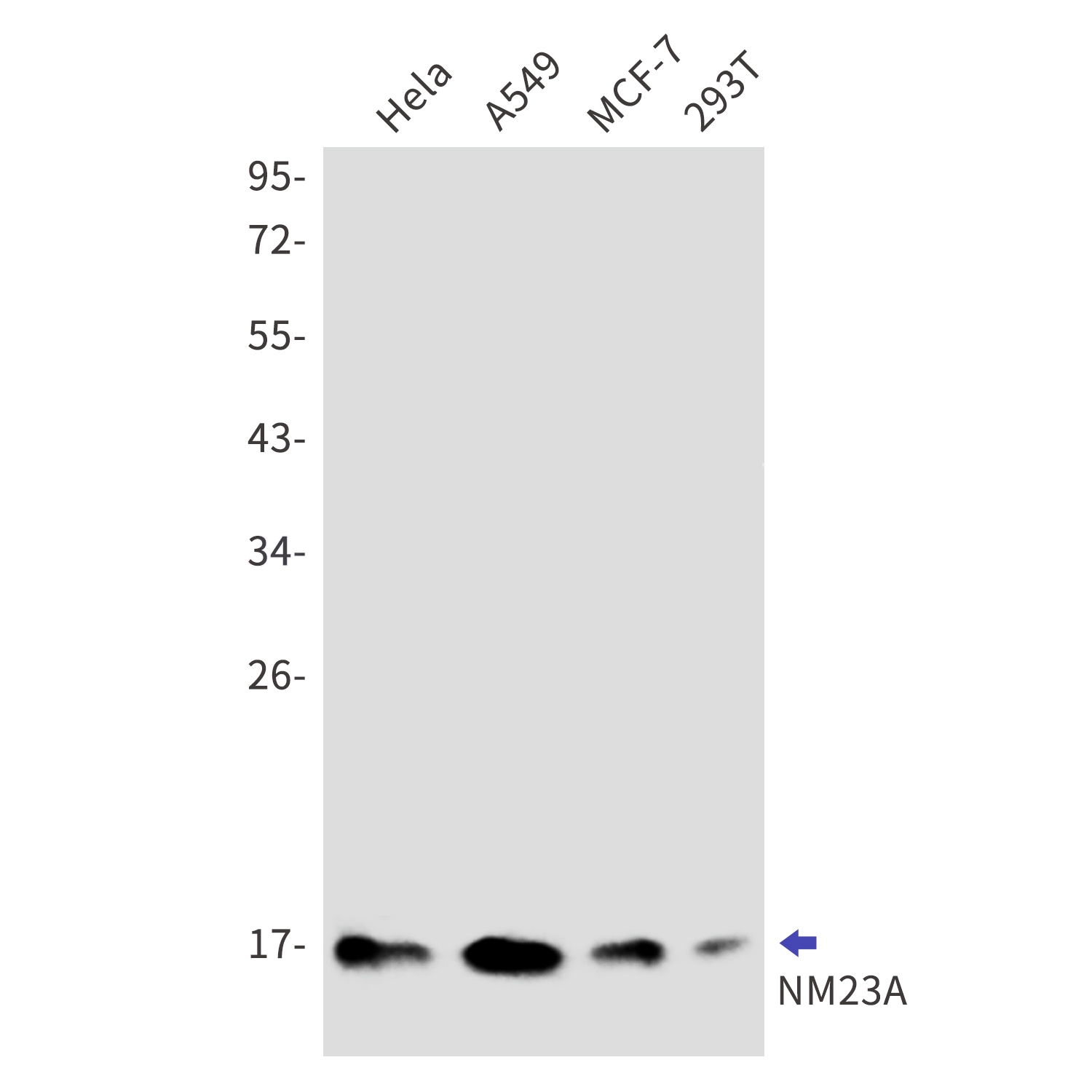 NM23A Rabbit mAb[52821]