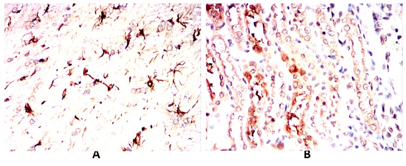 TNFSF11 Mouse mAb[64341]