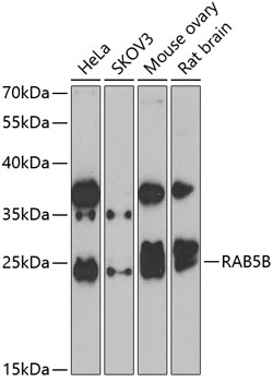 RAB5B Rabbit Polyclonal Antibo