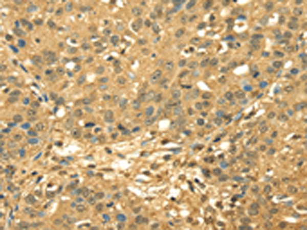 RPA2 Antibody[42740]