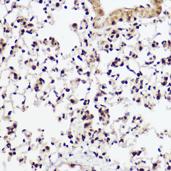 WBP11 Rabbit Polyclonal Antibo