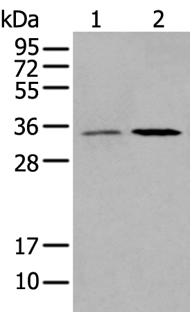 HOXB5 Antibody[43731]