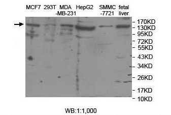 ASTN2 Antibody[39916]