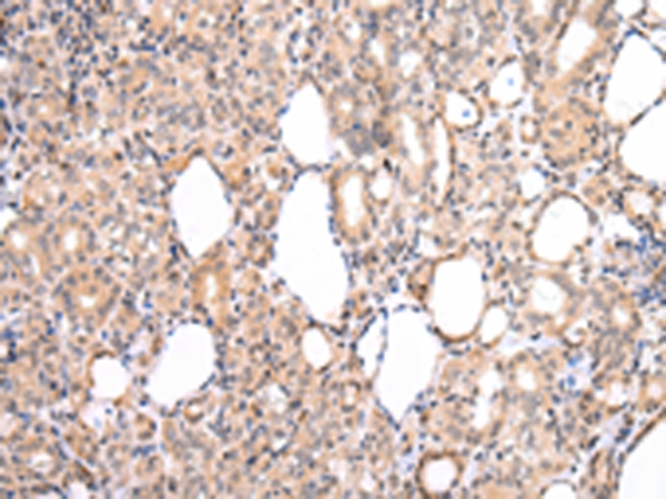 CDK8 Antibody[43234]